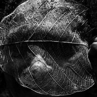 Mal da Amazônia