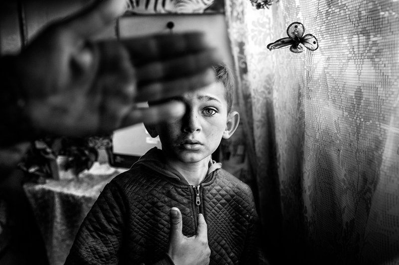 Bosnian Roma Child